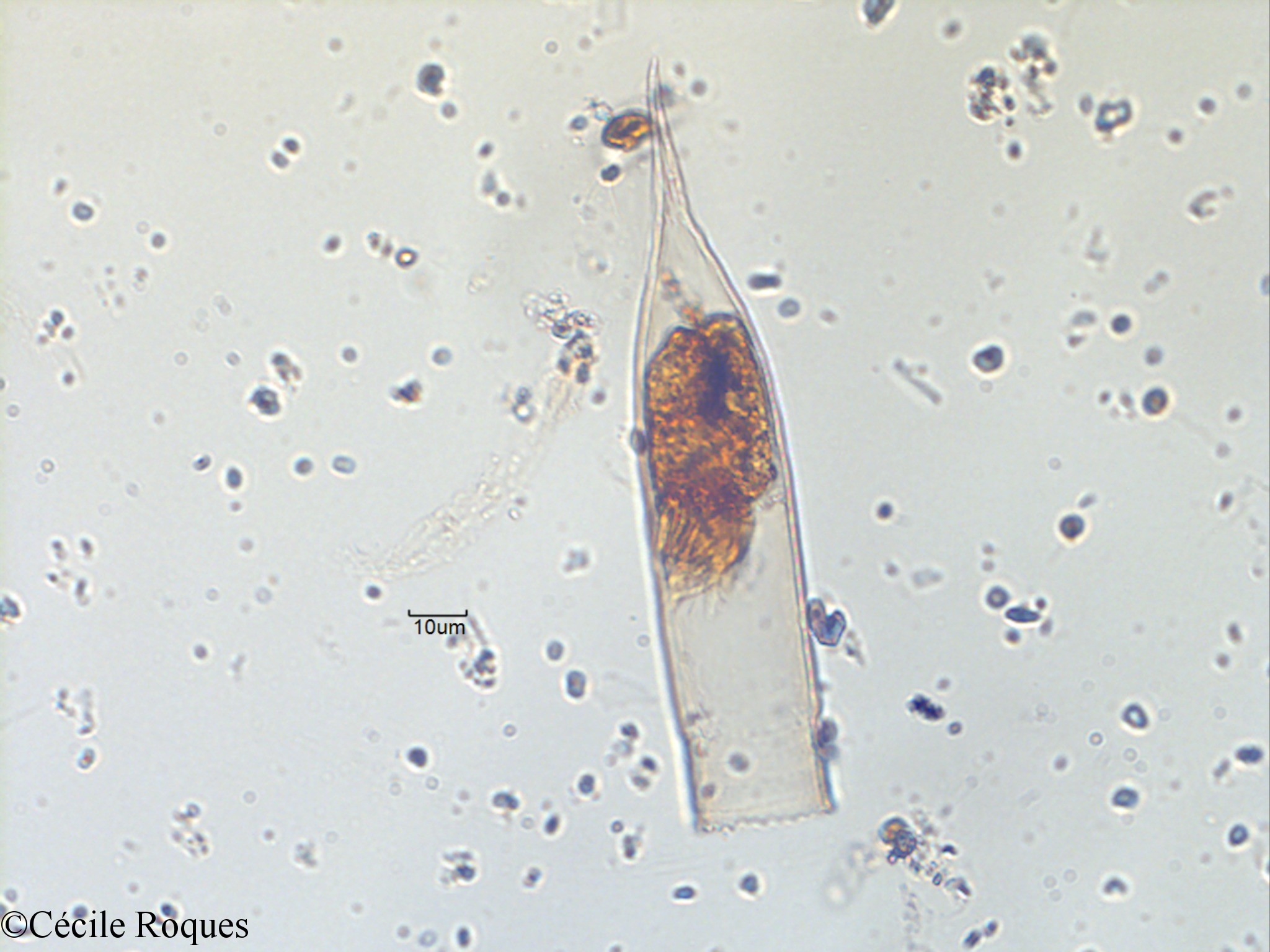 protozoo/Helicostomella subulata (1)(copy).jpg